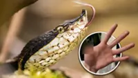 Chinese man hand-feeds pet snake, suffers serious bite, leads to thumb amputation
