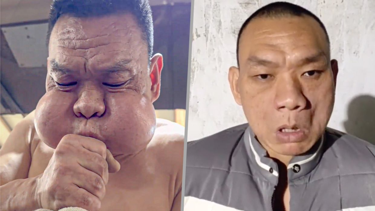 Chinese ‘frog prince’ glassblower has unusually protruding cheeks after 30 years of work