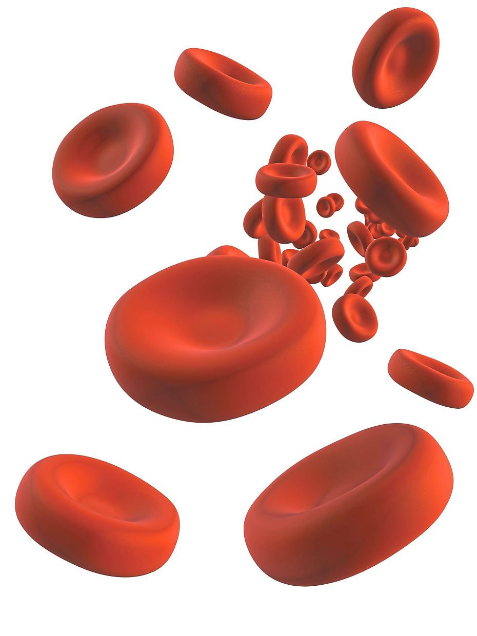 Anaemia can be caused by infection