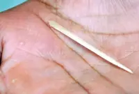 Boy stung by stingray at Penang beach discharged from hospital