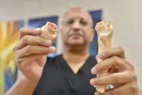 From the Vault: Hip fractures in the elderly, like Tun Mahathir, are serious