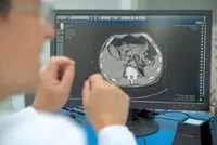 The AI that spots a silent killer