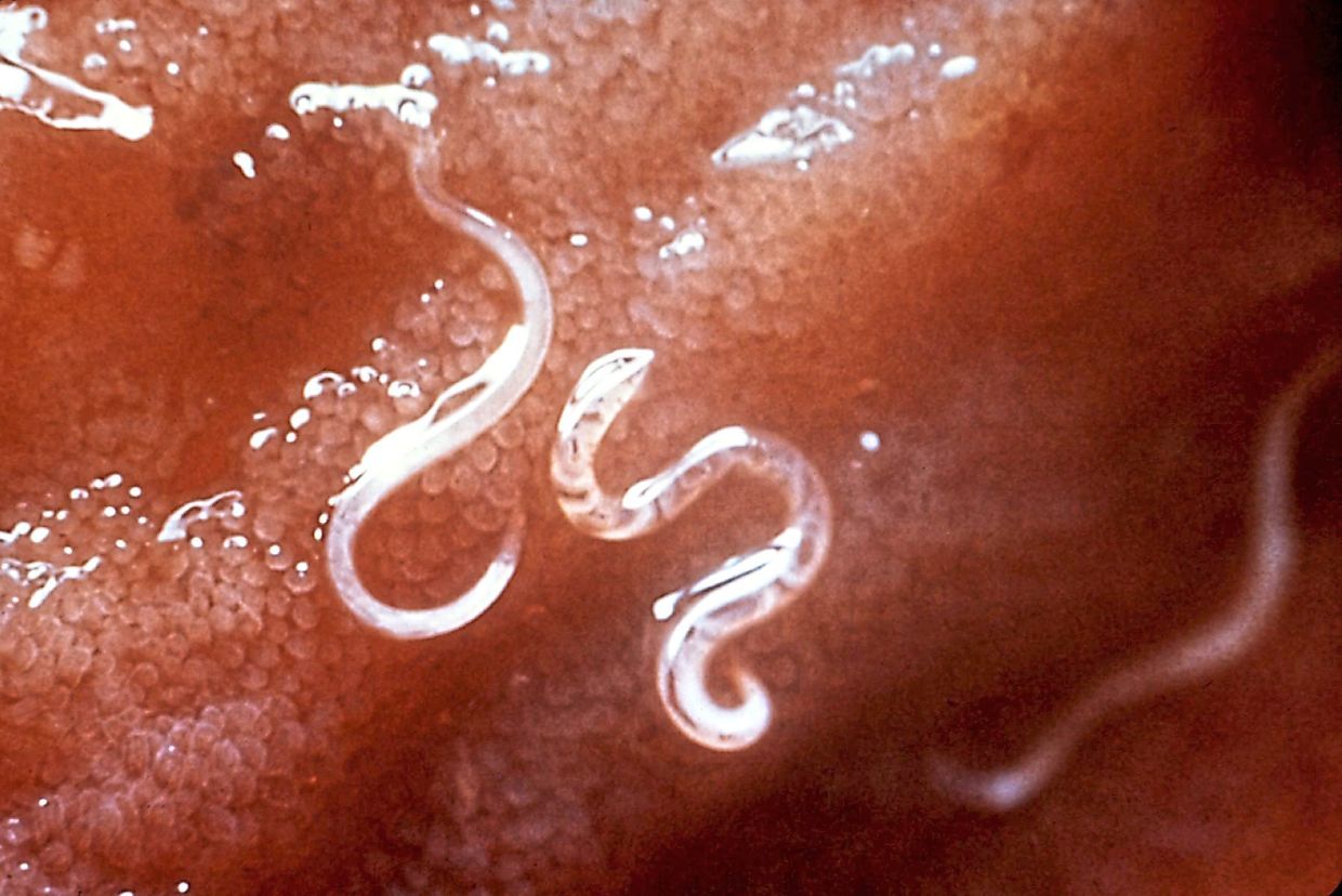 Soil-transmitted helminth infections are caused by a number of worms, including this hookworm Ancylostoma caninum, seen here attached to a patient’s intestinal mucosa. — US CDC
