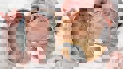 China baby hospitalised with 600 needle marks after mum stabs him for misbehaviour