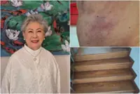 Singaporean actress Jin Yinji, 78, recovering after fall at home