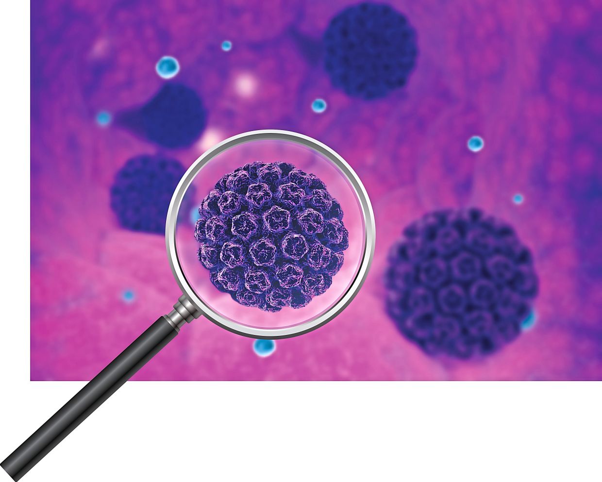 Changing the approach to eliminate cervical cancer