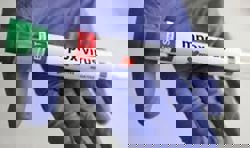 Prison inmate dies of mpox in Thailand; authorities urge calm