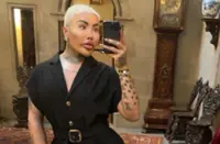 'Botched' star Jordan James Parke dies at 34, possibly following a cosmetic procedure