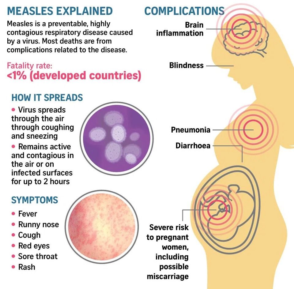 Illustration from The Straits Times/Asia News Network
