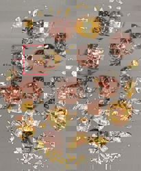 When your bile forms stones in the gallbladder