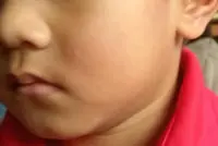 Man arrested for allegedly slapping four-year-old boy outside Woodlands pre-school