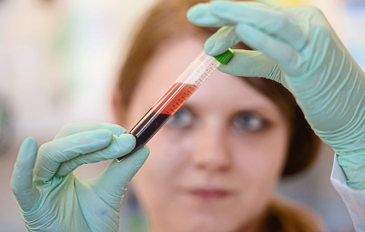 This test can predict dementia decades early