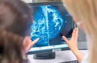 Six modifiable risk factors for breast cancer 