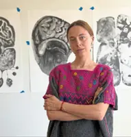 Artist turns experience raising her daughter with Angelman syndrome into art