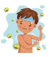 Chickenpox: Myths vs facts 