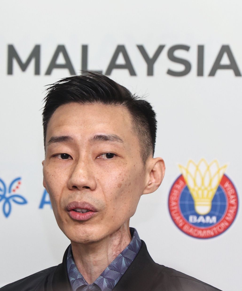 'I hope Zii Jia recovers soon and that his injury is not serious. I believe he is very important for the third men’s singles slot and the whole team need him.' - Datuk Seri Lee Chong Wei