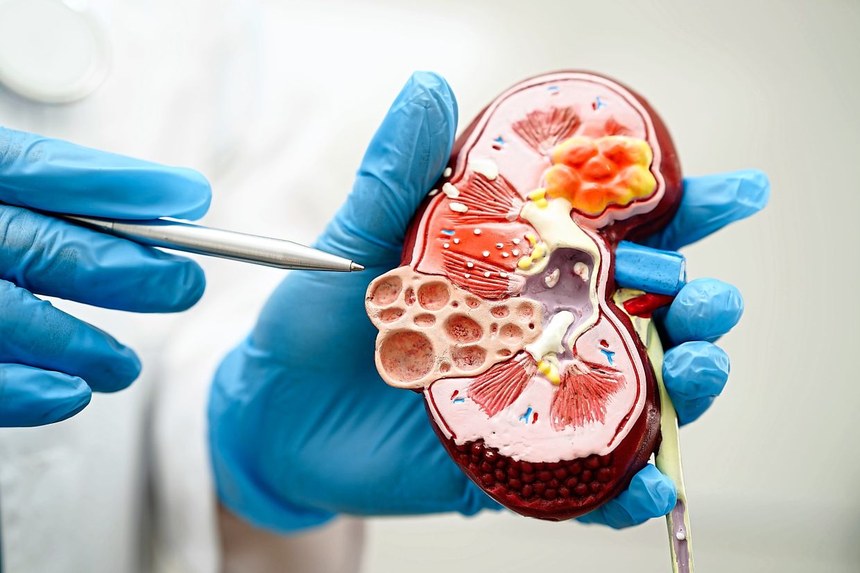 A diseased kidney affected ESKD, a severe condition that is estimated to double patient numbers from 54,000 to 106,000 by 2040.