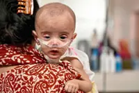 Emergency measles vaccinations launched amid deadly outbreak