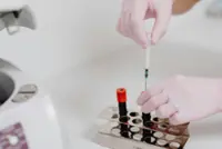 Haematologist shortage amid rising cases