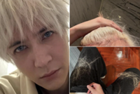 Chinese singer Joker Xue reveals hair loss due to constant dyeing for his shows