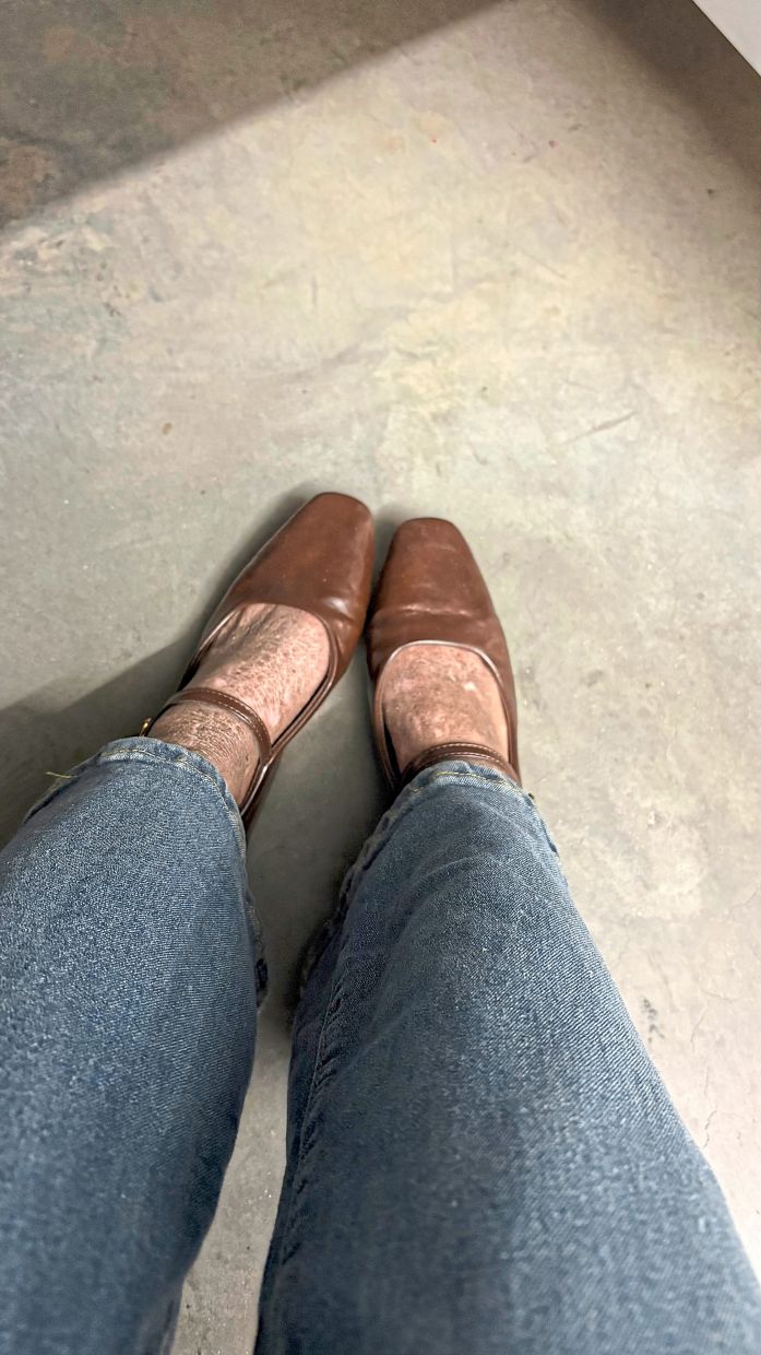 This was how Hasya’s skin looked before she started changing her diet and lifestyle.