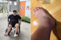 ‘If you’re overweight, don’t geh kiang’: Singaporean influencer injured foot after pull-up, triggering gout