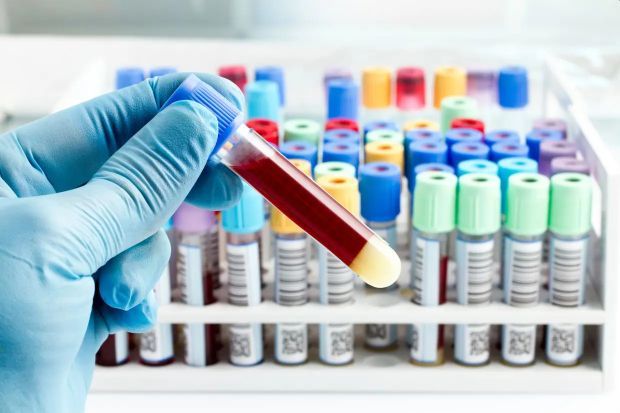 Facilities offering blood testing services without the required licence and approvals may face hefty penalties, the Health Ministry says.