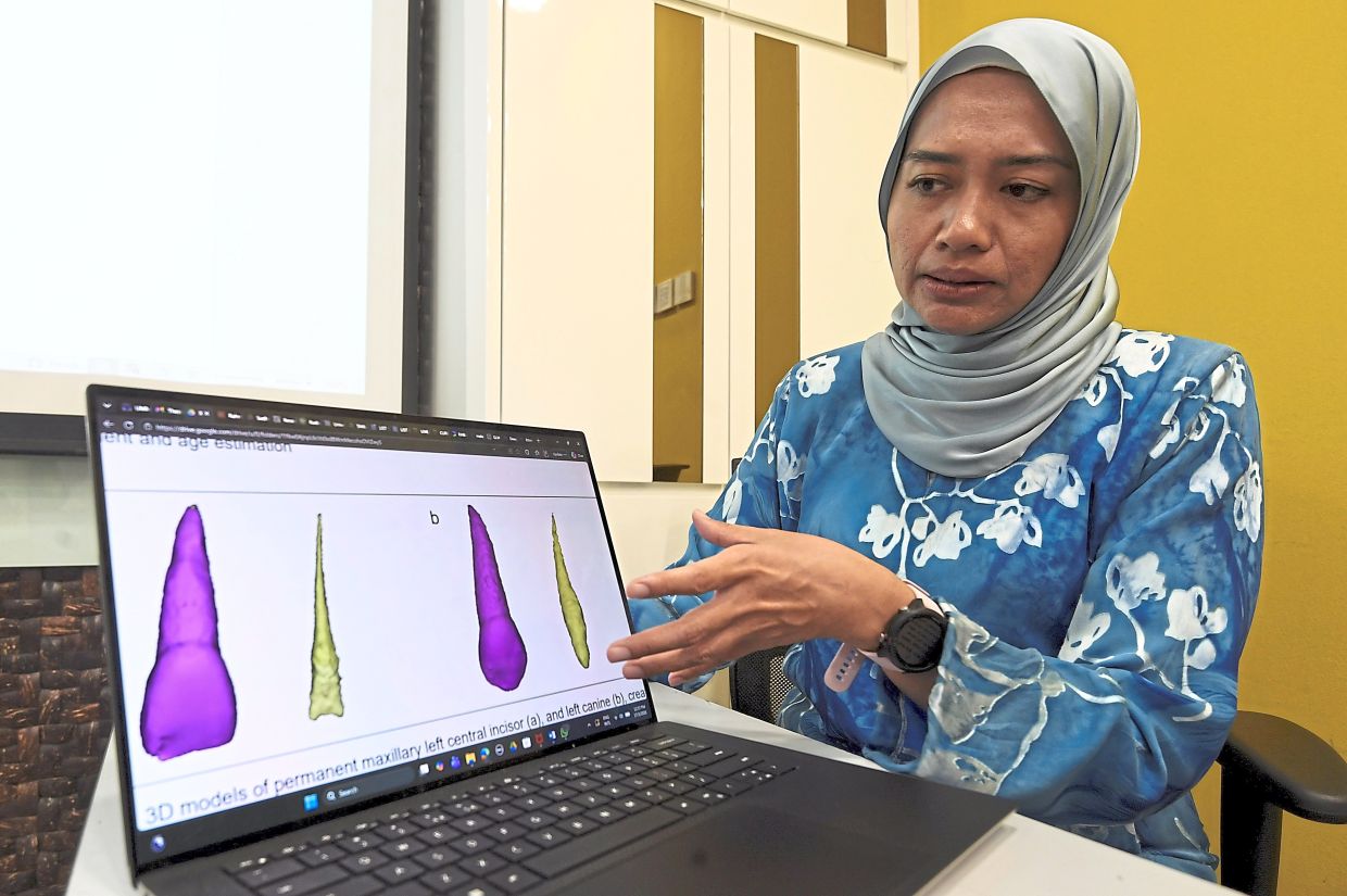 Forensic odontologists use computer programs to help with age estimation by gauging the amount of dental pulp (i.e. the soft tissue in teeth) left – the older the deceased, the less pulp volume they have. Here, Dr Rabiah shows the results with the tooth in purple and the pulp in green.