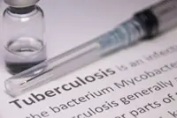 Authorities intensify TB prevention efforts after early-year surge