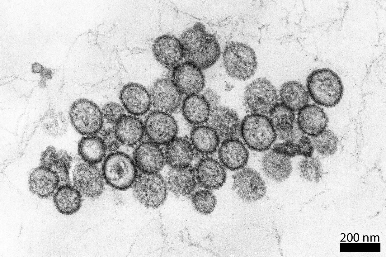An electron microscope image of hantaviruses (Puumala viruses), which can cause hantavirus pulmonary syndrome in humans. — Hans R. Gelderblom/RKI/dpa