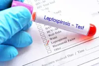 State Health Department probing possible leptospirosis cluster linked to Kuala Pilah recreation park