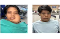 Sandakan hospital performs first complex jaw reconstruction surgery
