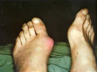 ‘It felt like a sharp needle had just stabbed me’