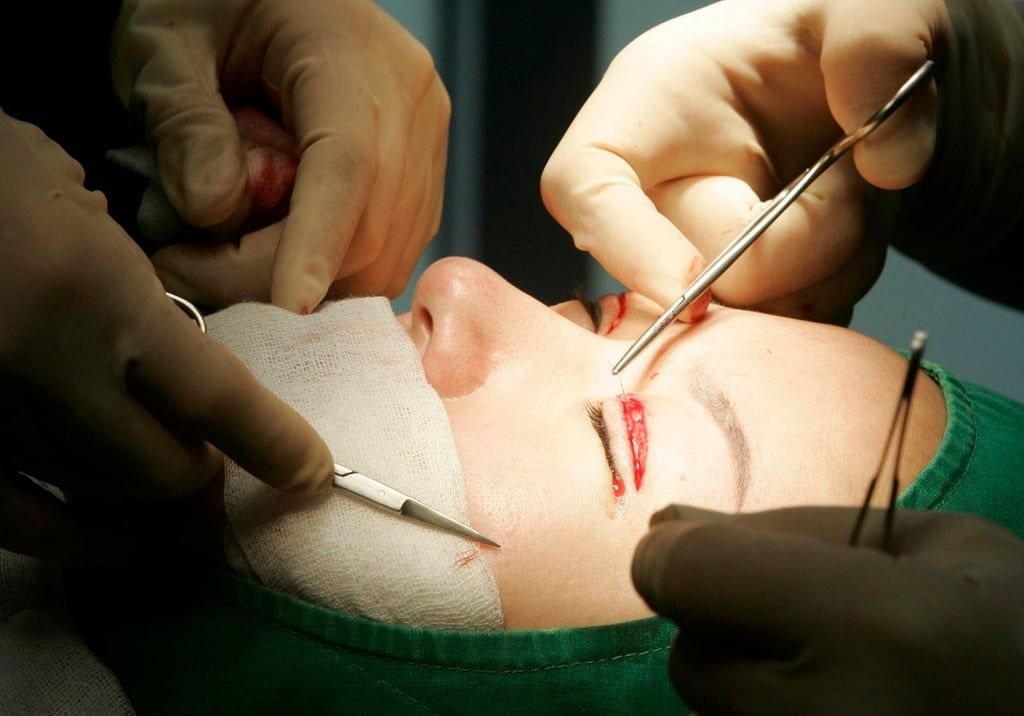A South Korean plastic surgeon performs double eyelid surgery on a Chinese woman, above. -- Photo: Reuters