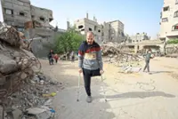 Lost limbs, destroyed hopes