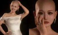 29-year-old Chinese influencer dies of cervical cancer