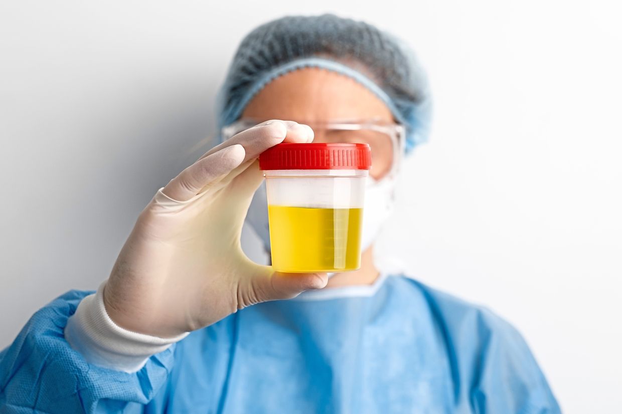 Lab-based urine tests offer a more comprehensive hormone profile than at-home tests. — Magnific