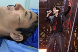 Singer Wang Leehom receives 39 stitches after heavy fall at concert in Chengdu