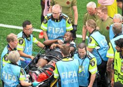 When a footballer sustains a fracture