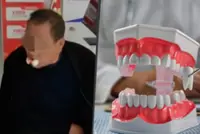 Chinese clinic extracts 12 teeth from man after he complains of ache in one tooth