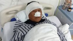 ‘True everyday hero’: Chinese man has nose bitten off saving woman from attacker