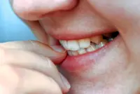 'Decoupling' technique to stop nail-biting