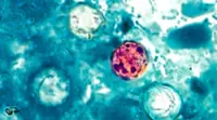 Why the parasite Cyclospora is so challenging to trace
