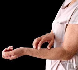 Scratching feels so good, but it’s actually bad for you