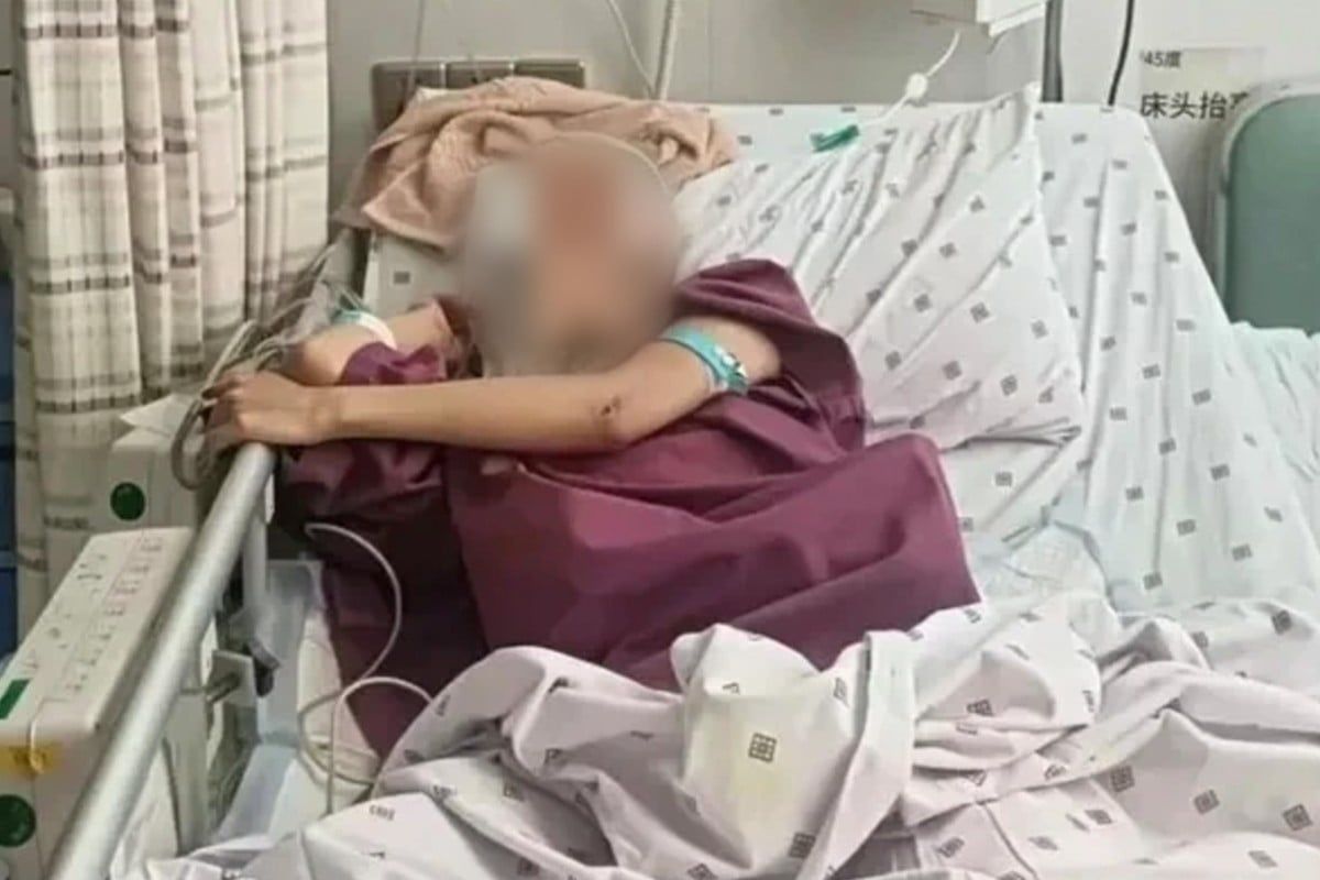 Chinese woman, 20, survives 18th floor ‘impulsive’ fall after argument with boyfriend