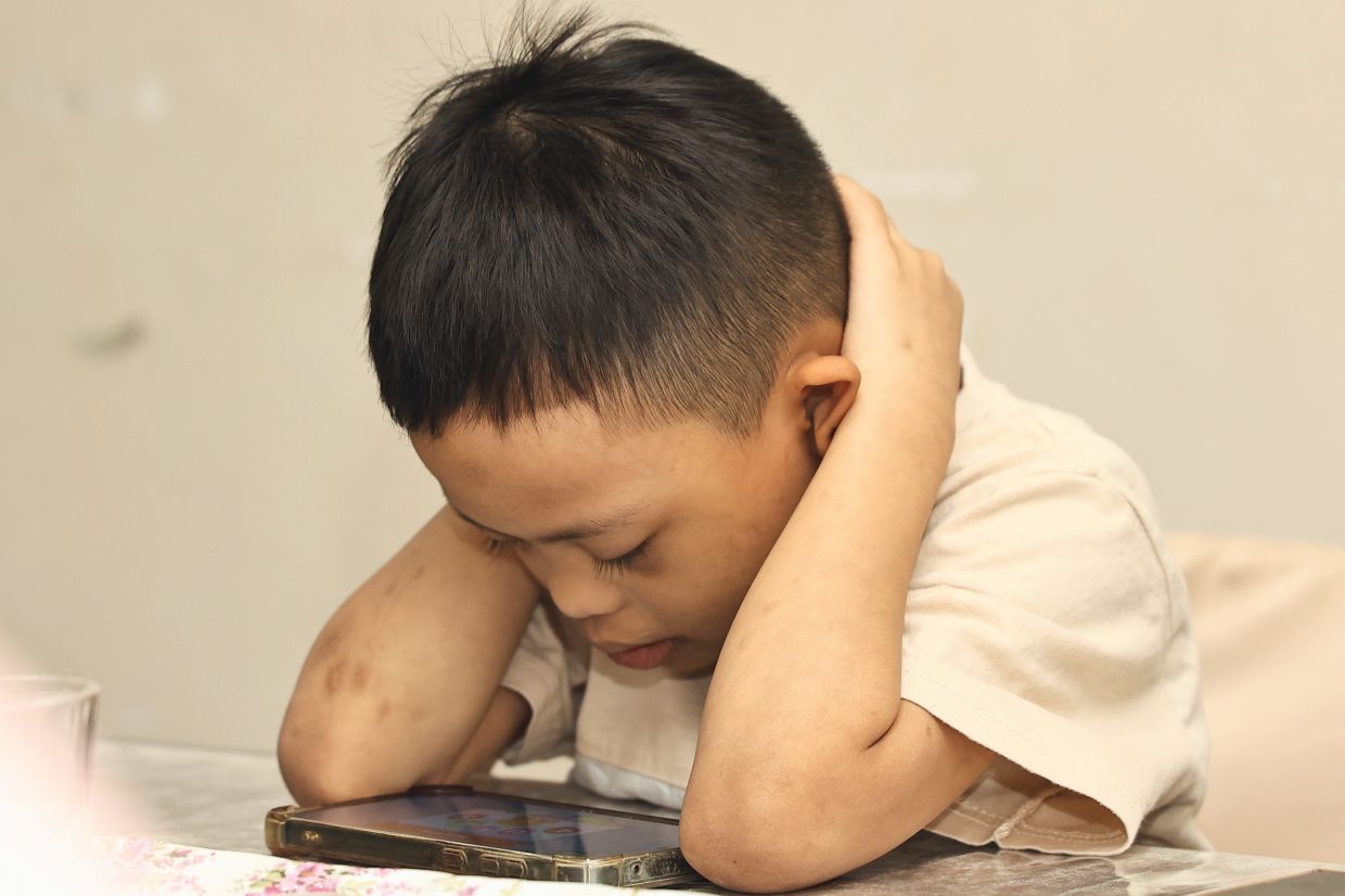 For children with disabilities, therapy plays an important role in developing fine and gross motor skills.