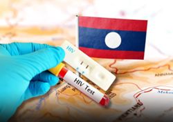 Thailand’s HIV cases pass 550,000, Laos reports rising infections among young people