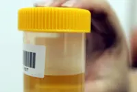 When another’s sample is used to cheat drug tests
