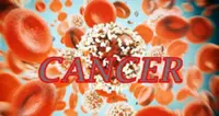 Young people can get colon cancer, too