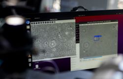 AI is finding sperm where doctors couldn’t
